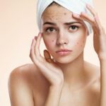 Kok Jerawat Nggak Kunjung Hilang Meski Sudah Rutin Pakai Skincare?